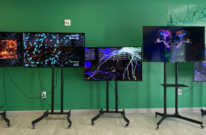 Five monitors on tall stands arranged in front of a green wall. Each monitor shows different graphics related to neural activity.
